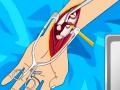 თამაშის Arm surgery 2