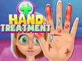 თამაშის Hand Treatment