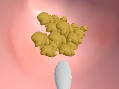თამაშის Earwax Clinic